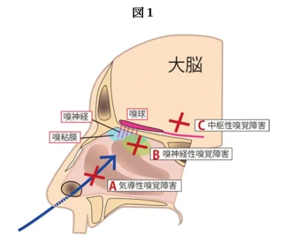 図1