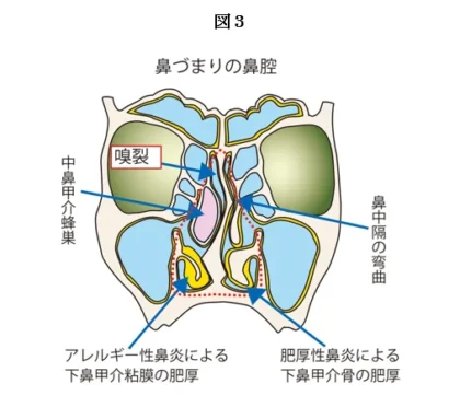 図3
