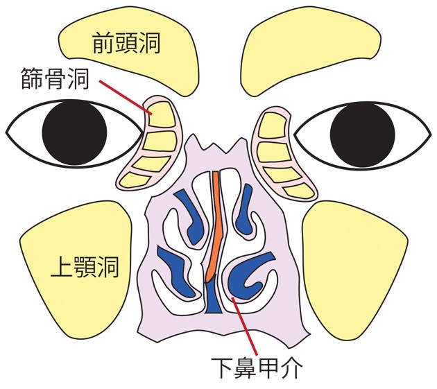 副鼻腔炎図1
